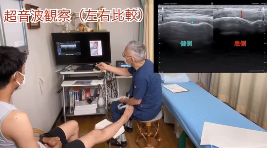 続超音波研修会.jpg